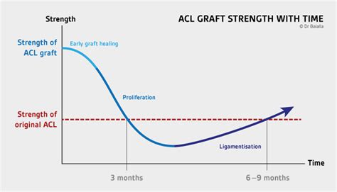 Achieving Your Dream of Recovery: A Step-by-Step Guide to Healing Your Hamstring Graft
